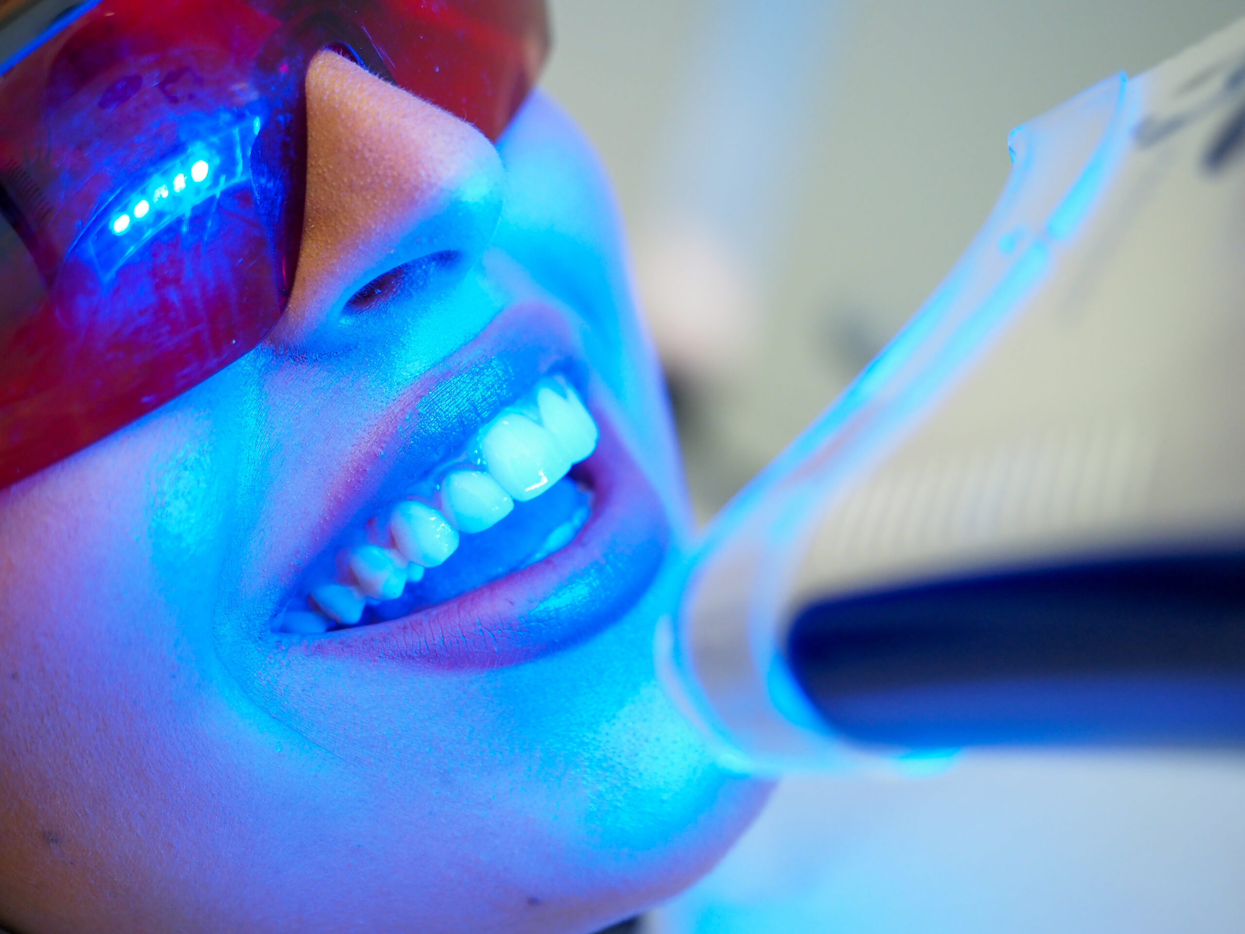 Best Teeth Whitening Turkey Price & Procedures