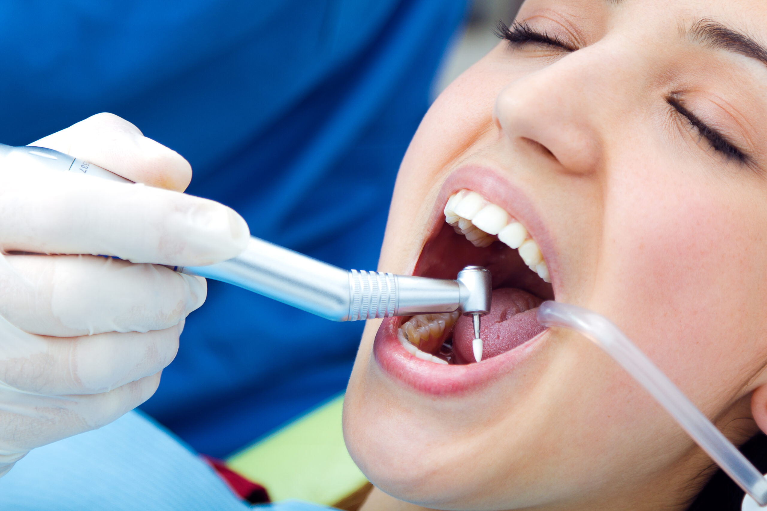 What is Endodontics? - Inci Dis Dental Clinic Turkey